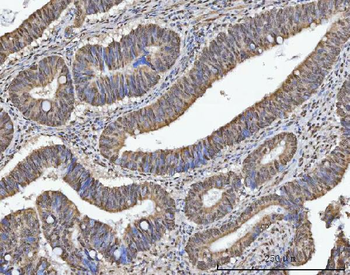 TRMT10C Rabbit Polyclonal Antibody