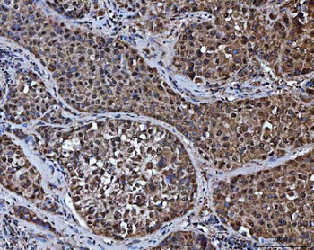 TRMT10C Rabbit Polyclonal Antibody
