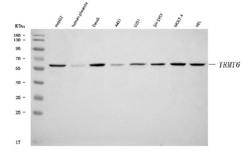 TRMT6 Antibody