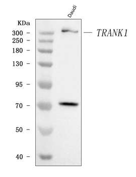 TRANK1 Rabbit Polyclonal Antibody