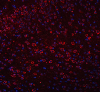 TRANK1 Rabbit Polyclonal Antibody