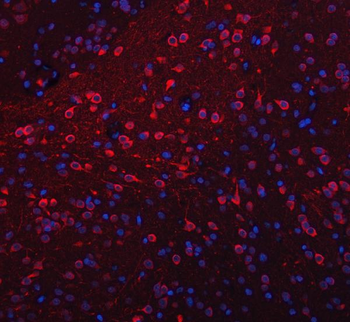 TRANK1 Rabbit Polyclonal Antibody