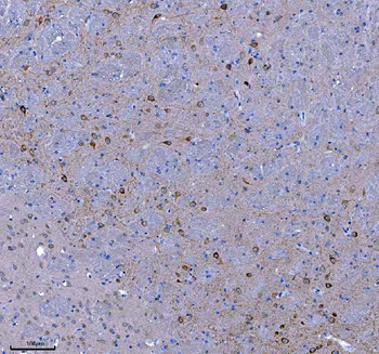 TRANK1 Rabbit Polyclonal Antibody