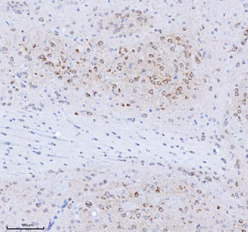 TRANK1 Rabbit Polyclonal Antibody