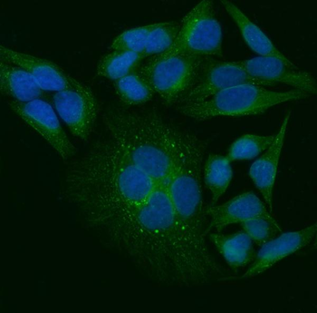 TRIP/TRAIP Rabbit Polyclonal Antibody