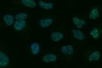Tripeptidyl peptidase II/TPPII/TPP2 Rabbit Polyclonal Antibody