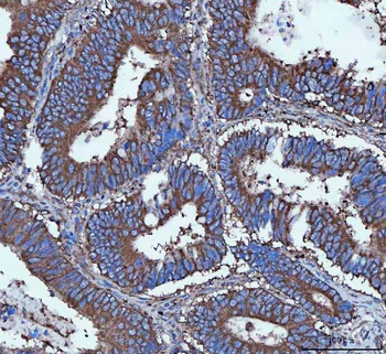 Tripeptidyl peptidase II/TPPII/TPP2 Rabbit Polyclonal Antibody