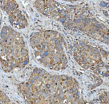 Tripeptidyl peptidase II/TPPII/TPP2 Rabbit Polyclonal Antibody