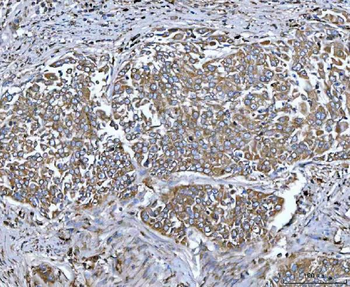 Tripeptidyl peptidase II/TPPII/TPP2 Rabbit Polyclonal Antibody
