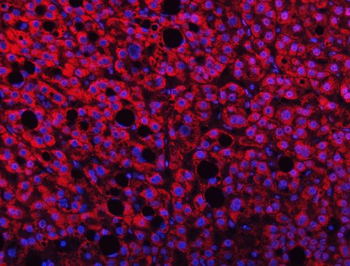 TMPRSS13 Rabbit Polyclonal Antibody