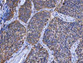 TMPRSS13 Rabbit Polyclonal Antibody