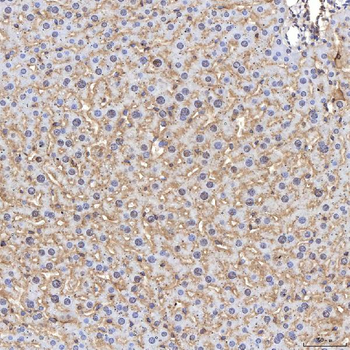 Tim 2/Timd2 Rabbit Polyclonal Antibody