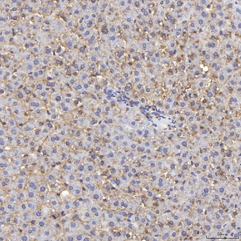Tim 2/Timd2 Rabbit Polyclonal Antibody