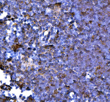 PD1/Pdcd1 Rabbit Polyclonal Antibody