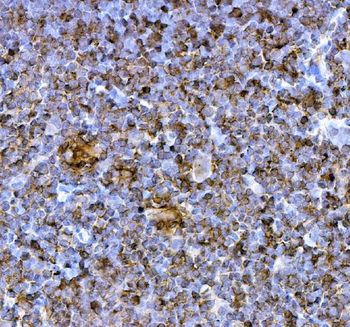 PD1/Pdcd1 Rabbit Polyclonal Antibody