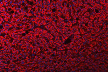 FRY Rabbit Polyclonal Antibody