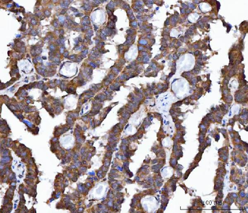 FRY Rabbit Polyclonal Antibody