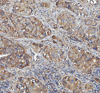 Kindlin 2/FERMT2 Rabbit Polyclonal Antibody
