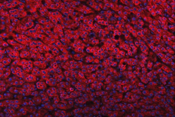 FADS1 Rabbit Polyclonal Antibody