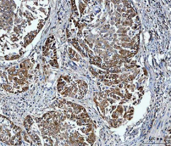 FADS1 Rabbit Polyclonal Antibody