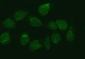 ZMYND8 Rabbit Polyclonal Antibody