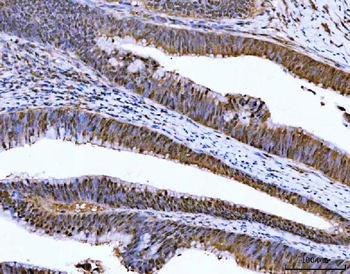 ZMYND8 Rabbit Polyclonal Antibody