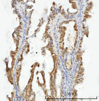 ZMYND8 Rabbit Polyclonal Antibody