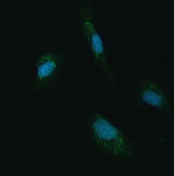 UBC12/UBE2M Antibody