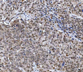 UBA6 Rabbit Polyclonal Antibody