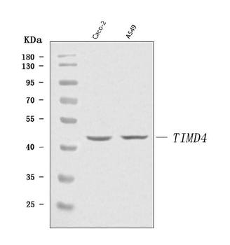 TIM 4/TIMD4 Rabbit Polyclonal Antibody