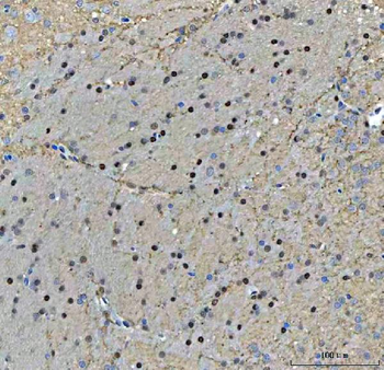 TIGD1 Rabbit Polyclonal Antibody