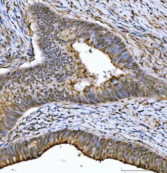 THAP11 Rabbit Polyclonal Antibody