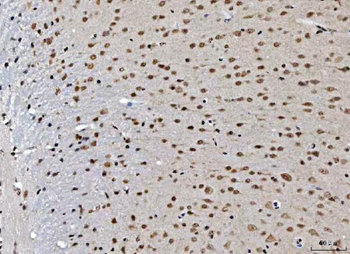 THAP11 Rabbit Polyclonal Antibody