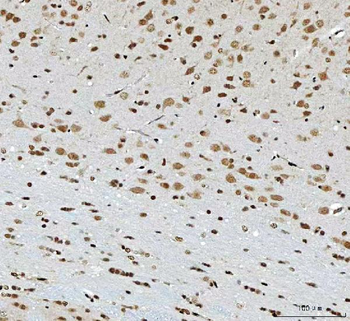 THAP11 Rabbit Polyclonal Antibody