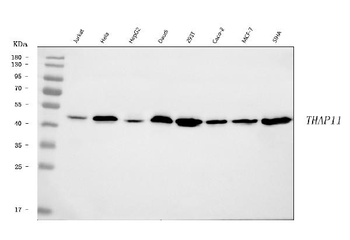 THAP11 Rabbit Polyclonal Antibody