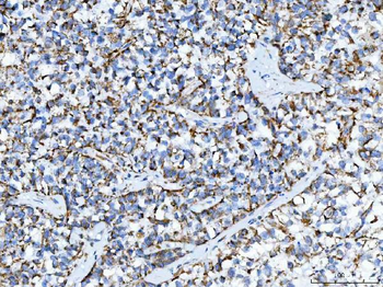 TRK fused gene/TFG Rabbit Polyclonal Antibody