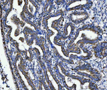 TRK fused gene/TFG Rabbit Polyclonal Antibody