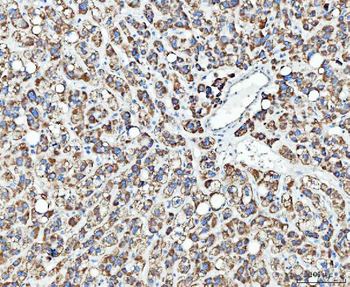 TRK fused gene/TFG Rabbit Polyclonal Antibody