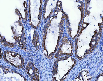 TRK fused gene/TFG Rabbit Polyclonal Antibody