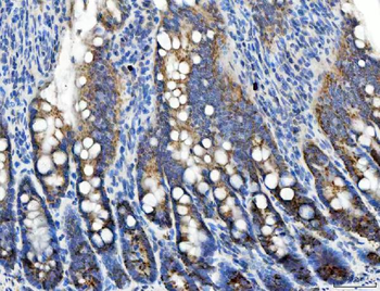 TRK fused gene/TFG Rabbit Polyclonal Antibody