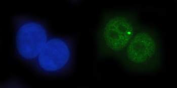 TDP2 Rabbit Polyclonal Antibody