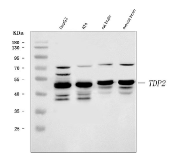 TDP2 Rabbit Polyclonal Antibody