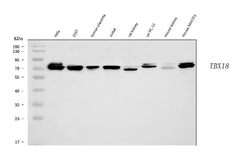 TBX18 Rabbit Polyclonal Antibody