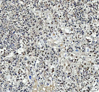 TBX18 Rabbit Polyclonal Antibody