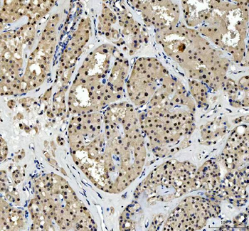 TBX18 Rabbit Polyclonal Antibody