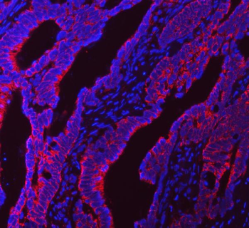 NDUFS5 Rabbit Polyclonal Antibody