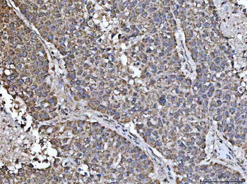 NDUFS5 Rabbit Polyclonal Antibody