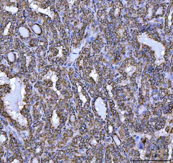 NDUFS5 Rabbit Polyclonal Antibody
