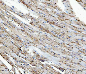 NDUFS5 Rabbit Polyclonal Antibody