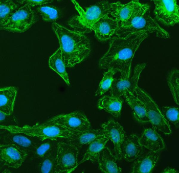 EPLIN/LIMA1 Rabbit Polyclonal Antibody